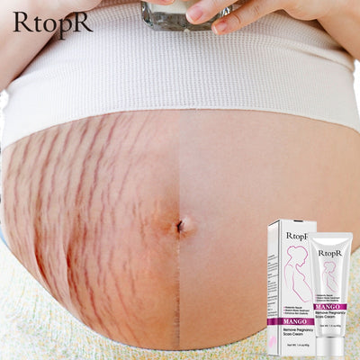 MATERNITY REPAIR ANTI-AGING ANTI WINKLES BODY CREAM + NOT SOLD IN STORES (LIMITED STOCK)